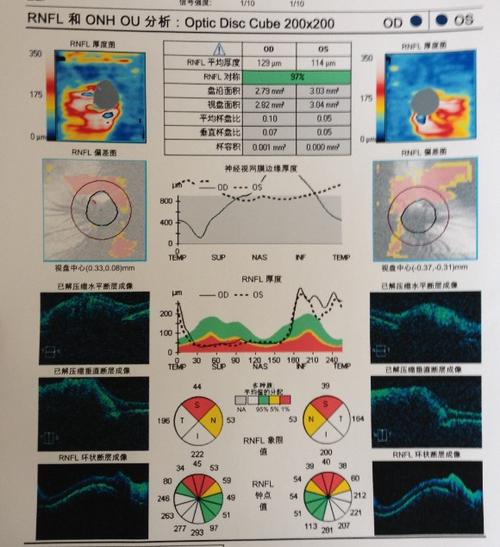 oct檢查有沒(méi)有副作用_oct檢查有沒(méi)有副作用啊