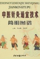 《中醫(yī)針灸適合技能簡明圖譜》