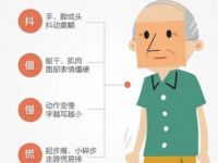 帕金森是什么??？有什么癥狀？_帕金森是什么病有什么癥狀能治好嗎視頻