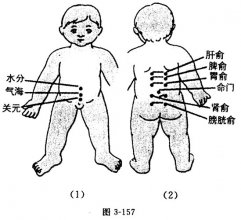 小兒命門穴位